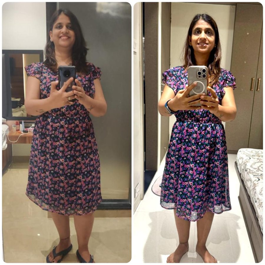 Madhuri before and after, wearing the same floral dress; visibly slimmer and more toned after