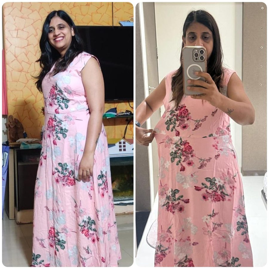 Madhuri before and after in the same pink floral dress, which is now loose at the waist